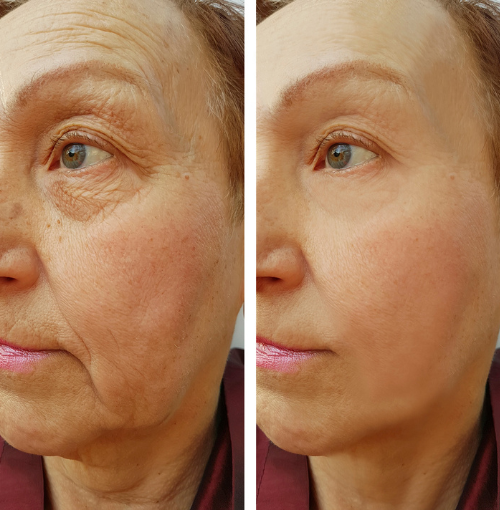 Opstrammende anti-age serum med peptider og kollagen til kvinder. Reducerer rynker for en fugtet, glattere hud.