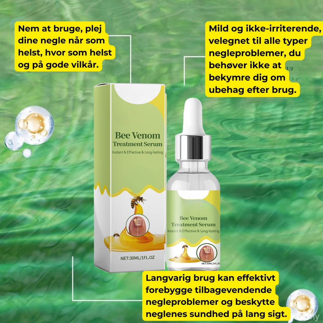 Før og efter neglebehandling: Stærke fingernegle uden misfarvning. Effektiv svampebehandling.