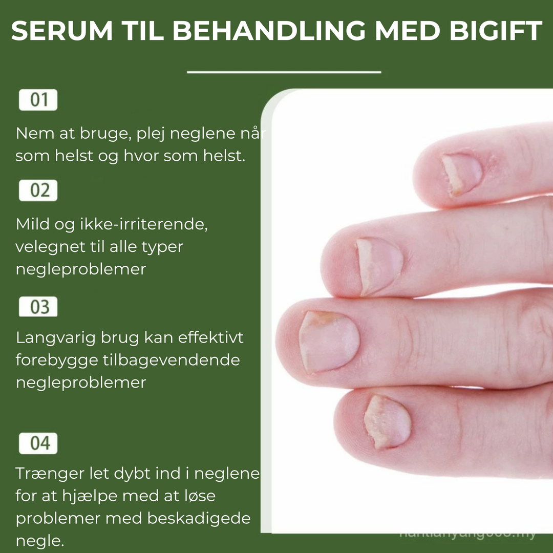 Nærbillede af serum mod neglesvamp. Let at påføre, fremmer sunde negle og pæn skønhed.