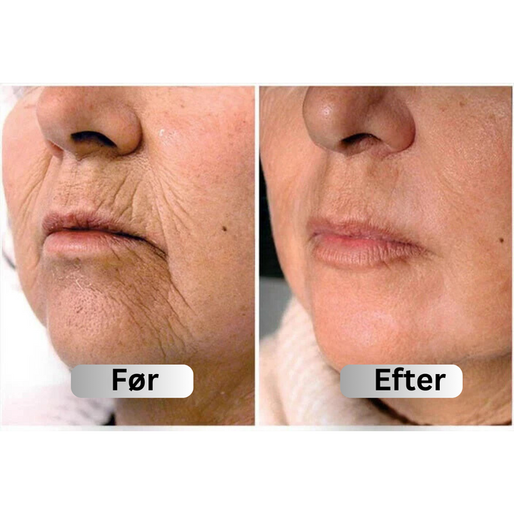 Opstrammende hudpleje serum, der reducerer slap hud og giver fasthed til ansigtet.