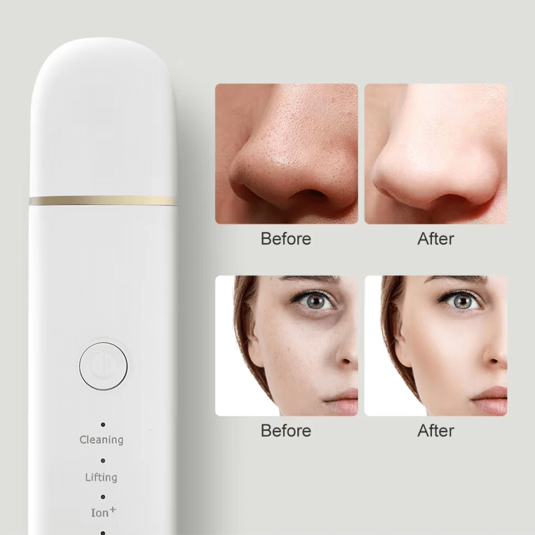 Ultralyds Ansigtsrenser Ansigts Pore Behandling