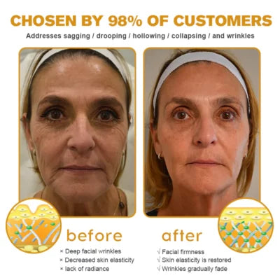 AeroBripe™ Anti-Aging creme i elegant emballage, der giver fugt, reducerer rynker og forbedrer hudstrukturen for skønhed og sundhed.