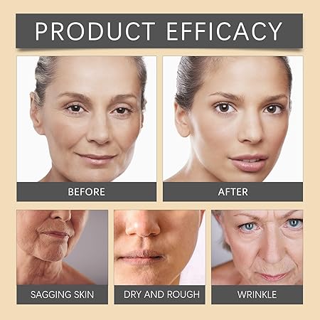 AeroBripe™ Anti-Aging creme i elegant emballage, der giver fugt, reducerer rynker og forbedrer hudstrukturen for skønhed og sundhed.