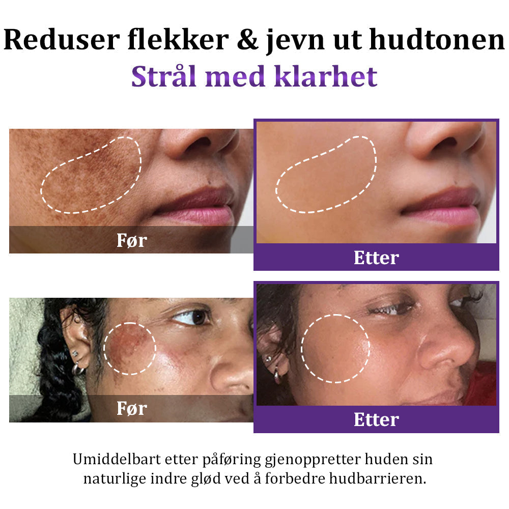 Magisk creme mod mørke pletter. Udglatter hudens struktur for en ungdommelig og sund glød.