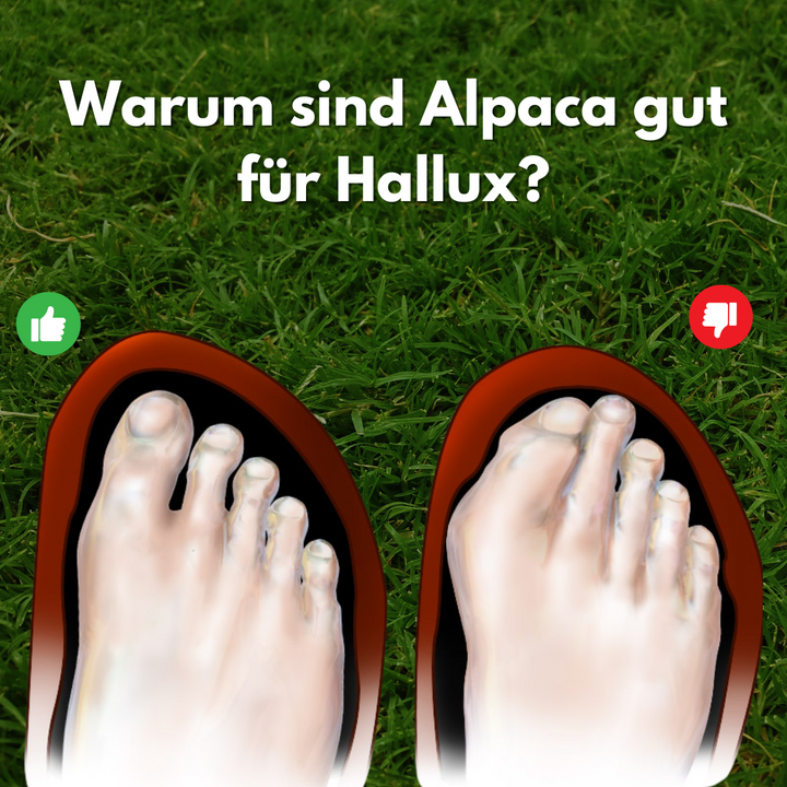 Alpaca Hallux Valgus læder barfodssko for optimal komfort og smertefrihed