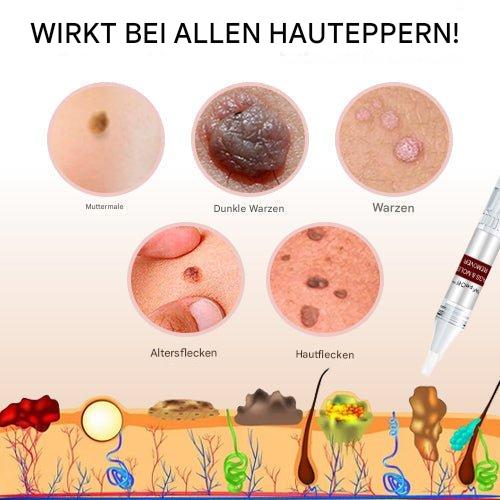 Hudpletfjerner med naturlig formel i pumpeflaske, ideel til hjemmebrug, hurtige resultater, ikke-invasiv anvendelse