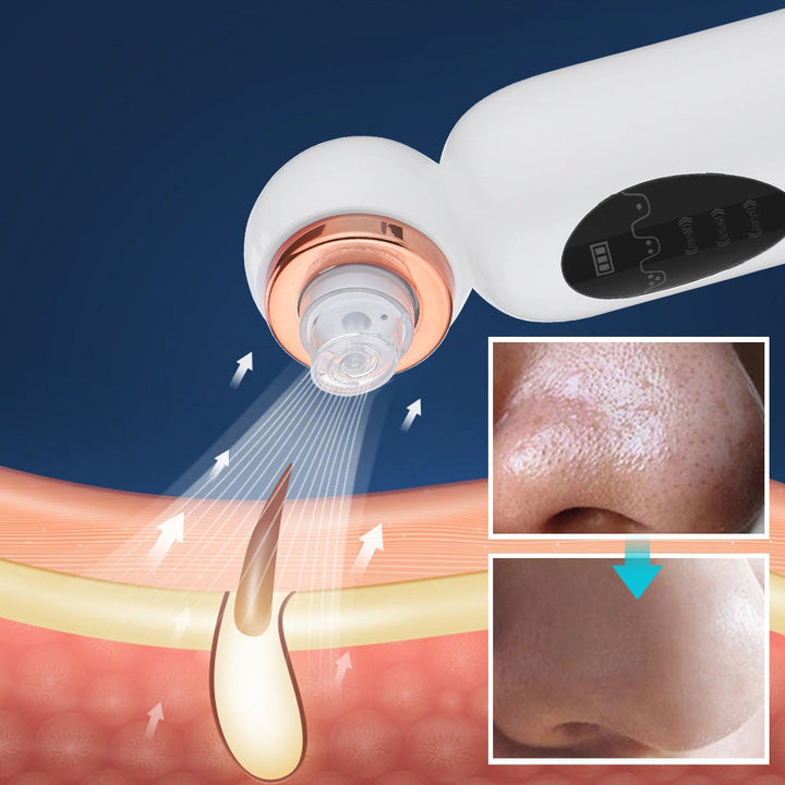 Professionel hydrodermabrasion maskine til dybdegående hudrensning, mod hudorme og urenheder, hjemmebrug.